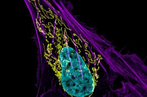 Terapia genică țintită închide centrele energetice ale celulelor canceroase