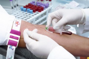 Leucemia mieloidă acută