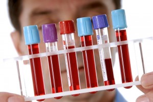 Leucemia limfoidă acută