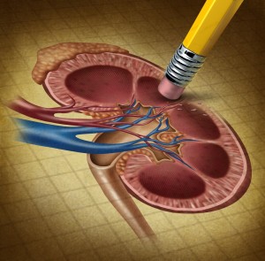Cancerul renal (de rinichi)