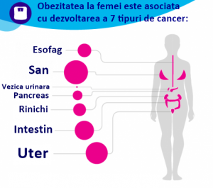 Obezitatea la femei, asociată cu 7 tipuri de cancer