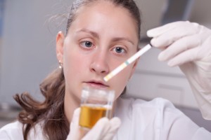 Testul de urină care detectează cancerul de prostată