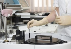 Testul care ar putea facilita diagnosticarea timpurie a cancerului esofagian