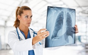 Tumorile pulmonare