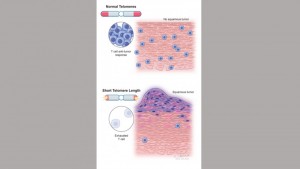 Descoperiri recente ar putea duce la îmbunătățiri în prevenirea cancerului la persoanele cu sindroame determinate de scurtarea accelerată a telomerilo