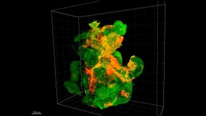 Cercetătorii au reușit optimizarea terapiei anticancer cu ajutorul nanoparticulelor
