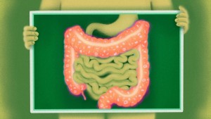 Mecanismul prin care imunoterapia împotriva cancerului cauzează probleme gastrointestinale