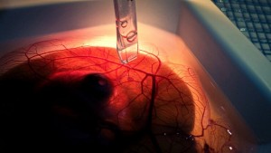 Chimioterapia iontronică continuă reduce creșterea tumorii cerebrale la modelele aviare embrionare in vivo