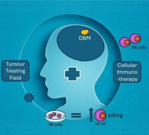 Curenții electrici ar putea supraîncărca celulele imunitare care ucid cancerul