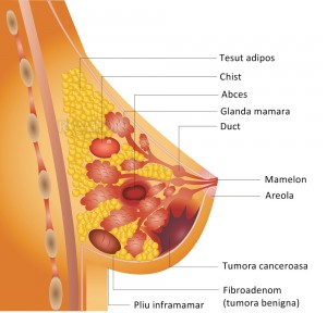 Fibroadenomul mamar