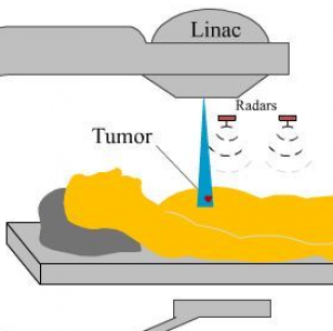 Doza de radiații în cancer