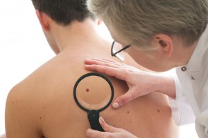 Alunița vs melanomul