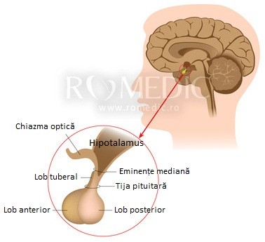 adenom hipofiza simptome